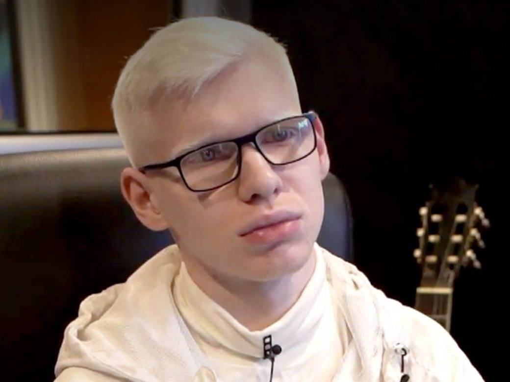  albino krajiski trep viral video 