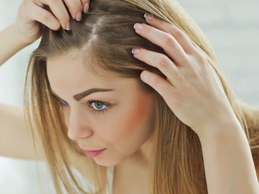  Opadanje kose posle korone i kako ga lečiti 
