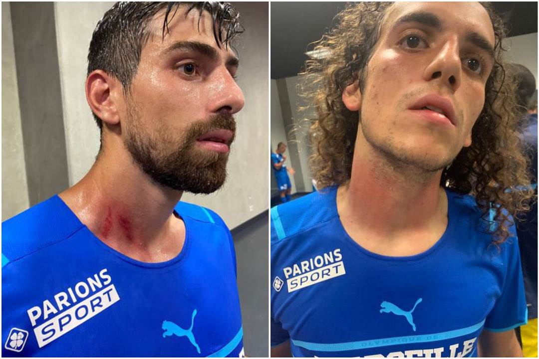  Povrede fudbalera Olimpik Marseja tokom tuče sa navijačima Nice 