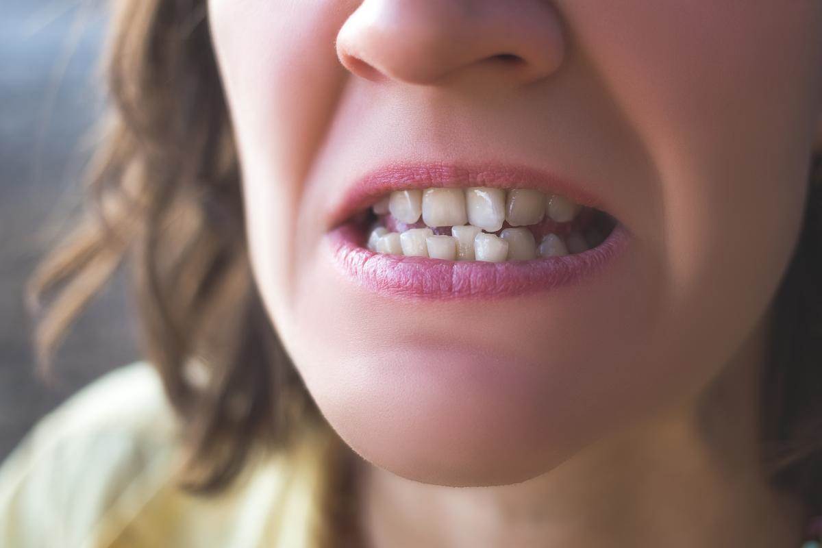  Kako krivi zubi štete zdravlju 