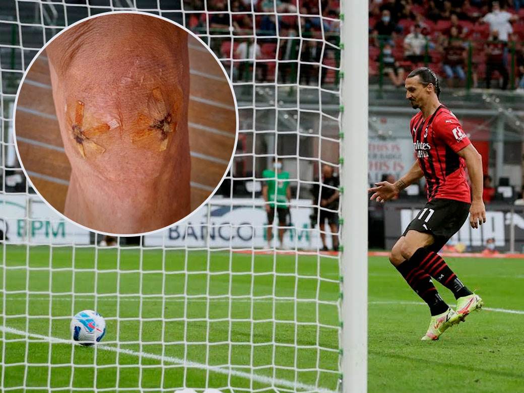  Zlatan Ibrahimović objavio sliku posle operacije 