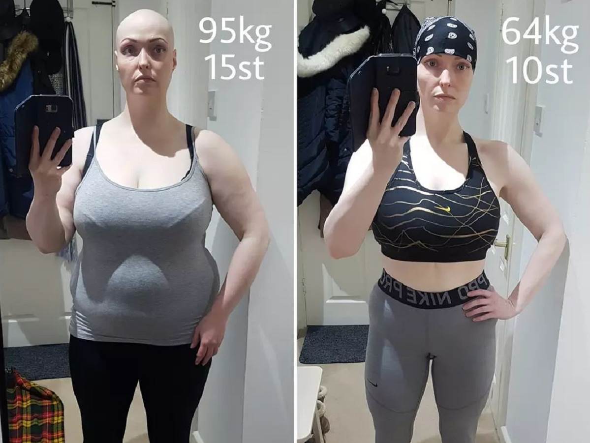  Žena smršala 37 kilograma kad je izbrisala društvene mreže 