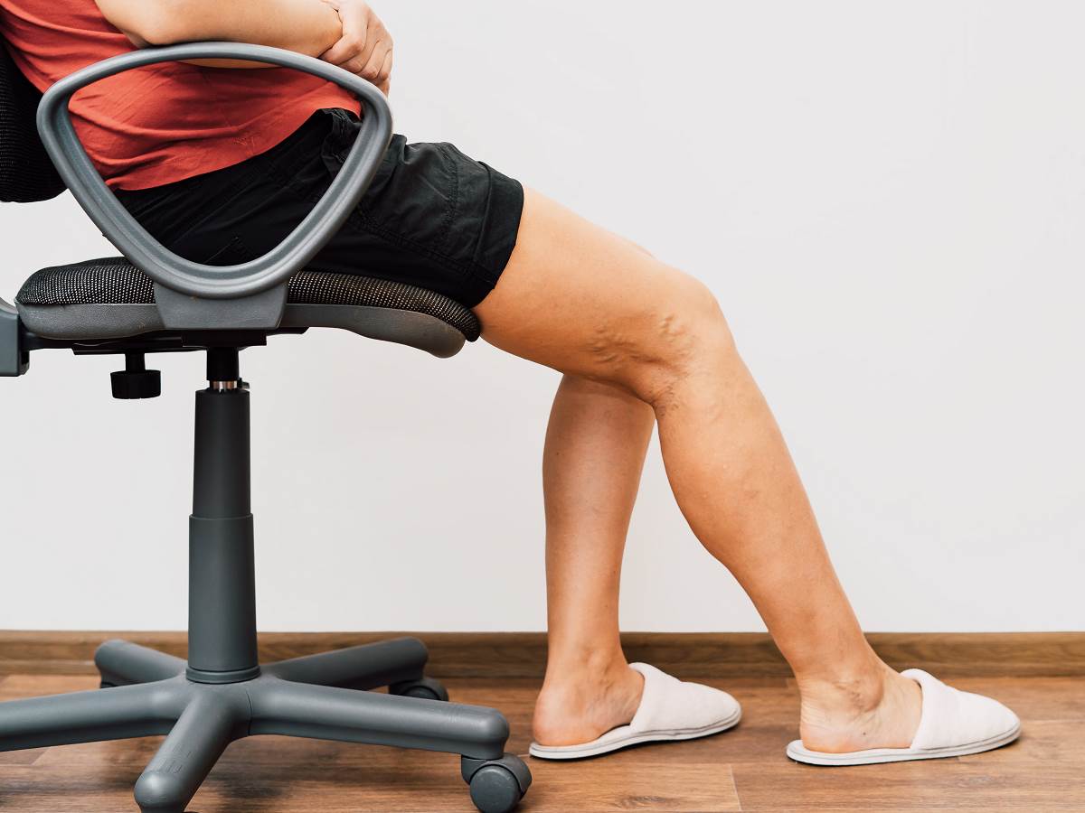  Sedenje uticaj na zdravlje i vene 