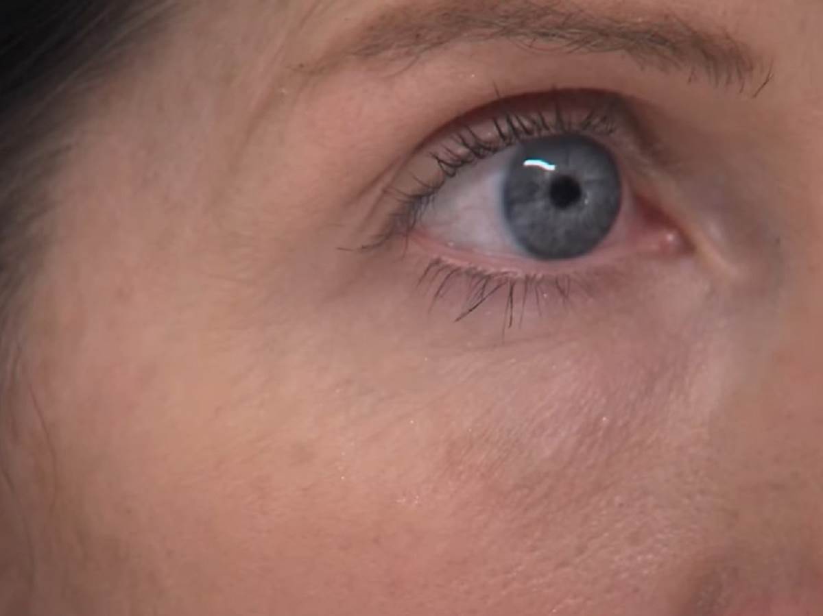 Igranje oka simptom manjka vitamina B12 