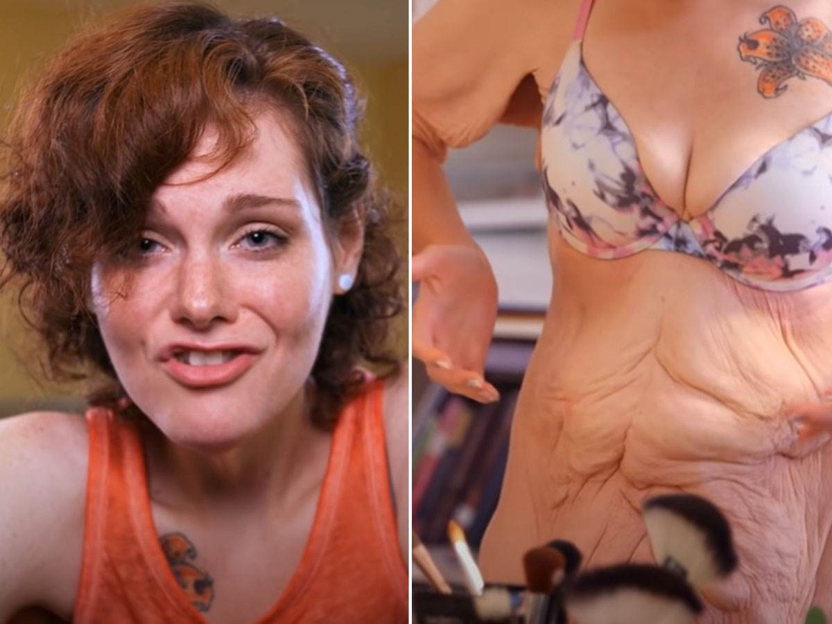  Devojka smršala 152 kilograma 