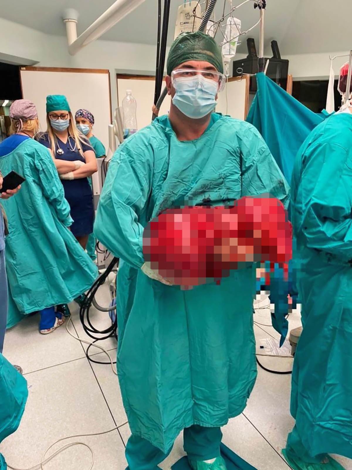  Hirurzi na VMA odstranili tumor od 17 kg i pola metra 