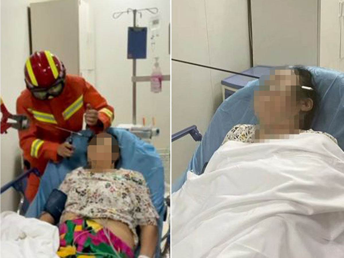  Ženi prošla kroz obraz strela od 70 cm u Kini 