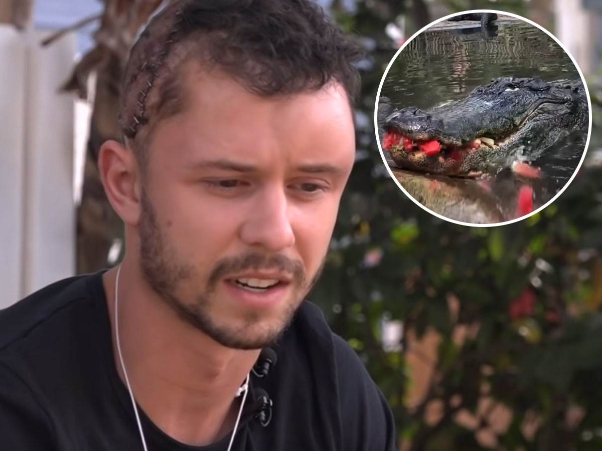  Muškarac preživeo napad aligatora na Floridi 