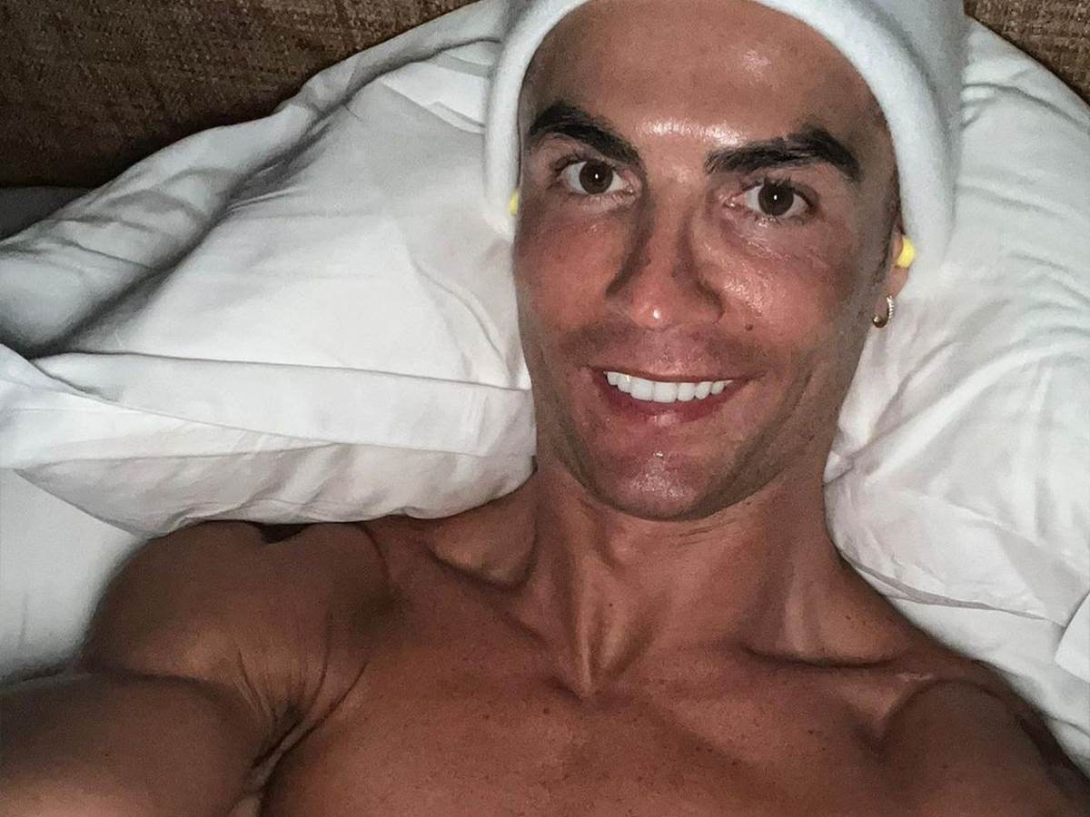  Kristijano Ronaldo prima botoks u genitalije 