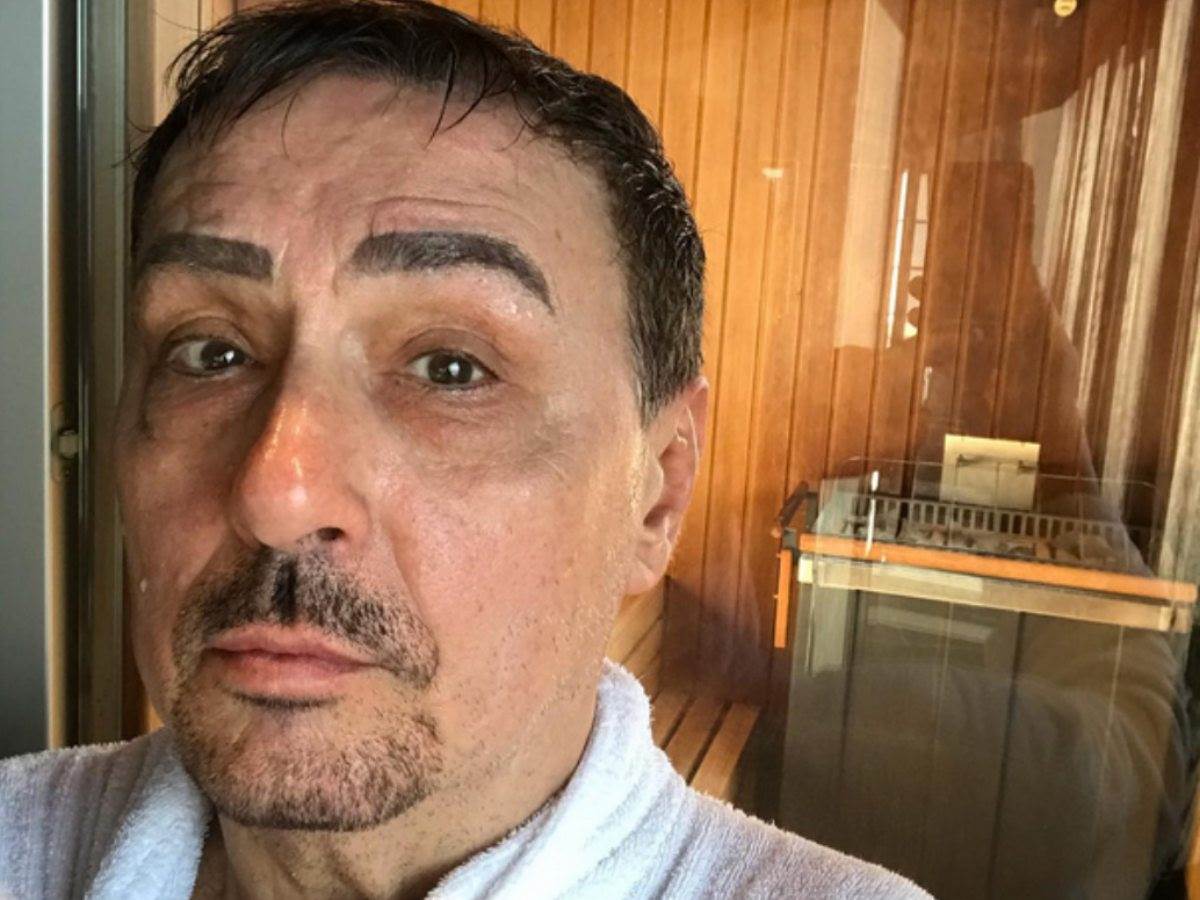  Dragan Kojić Keba otkrio da lice neguje kiselom vodom 