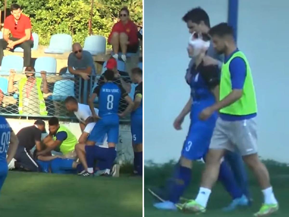  Hrvatski fudbaler udario glavom u zid tokom utakmice 