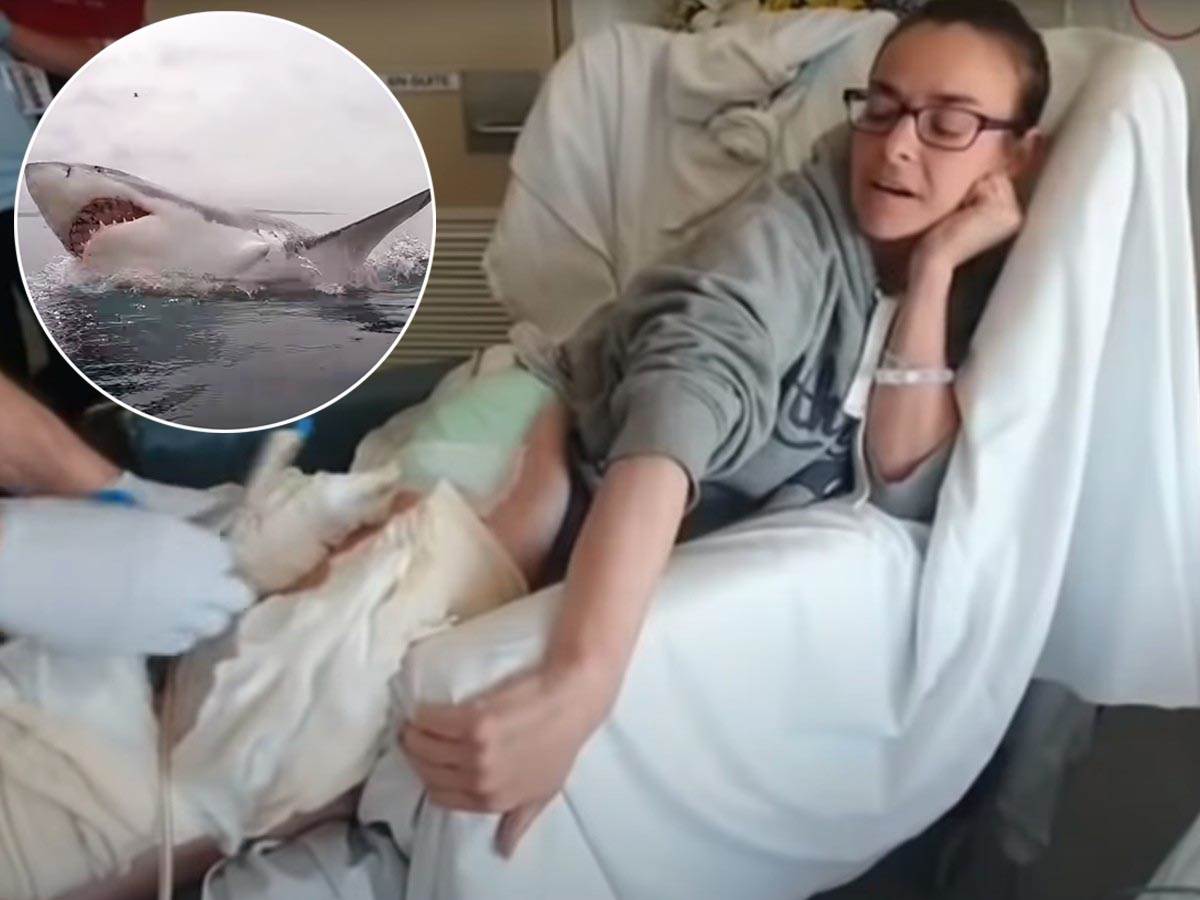  Ženu napala ajkula u Australiji, spasio je muž 