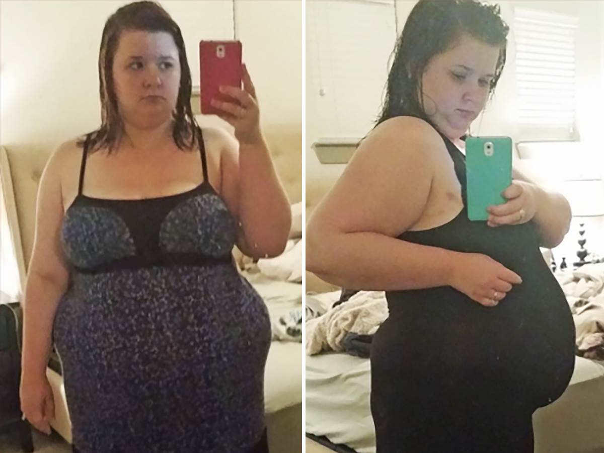  Transformacija devojke koja je imala 125 kg 
