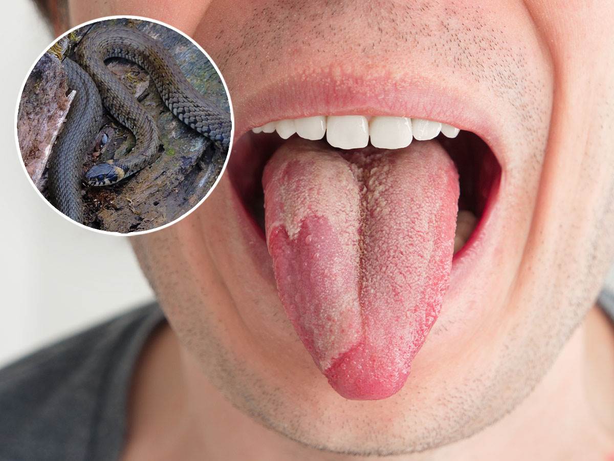  Čoveka ujela zmija za jezik, amputirali ga 