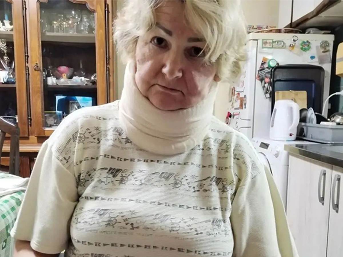  Oglasila se žena pretučena na pijaci u Beogradu 