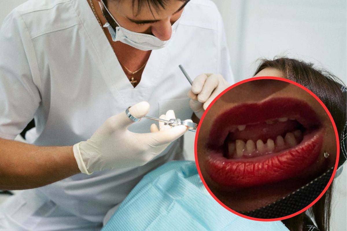  Koliko koštaju stomatološke usluge u Srbiji 