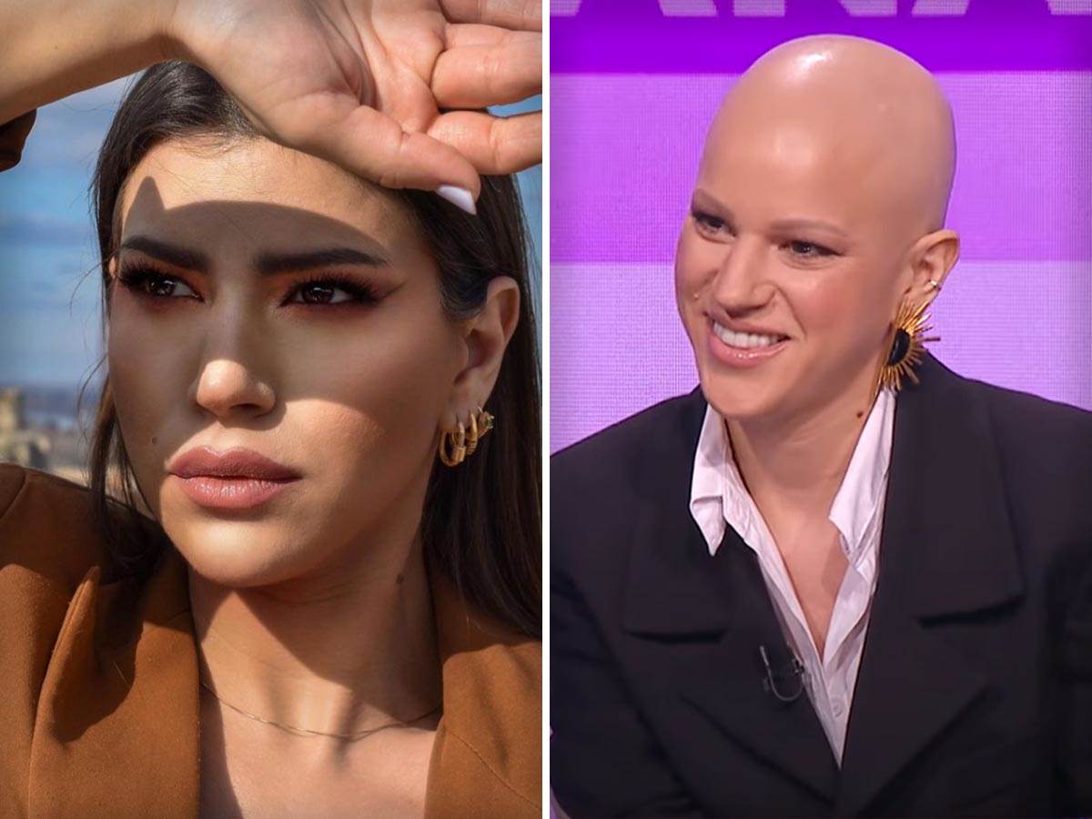  Sonja Milosavljević Beograđanka o alopeciji 