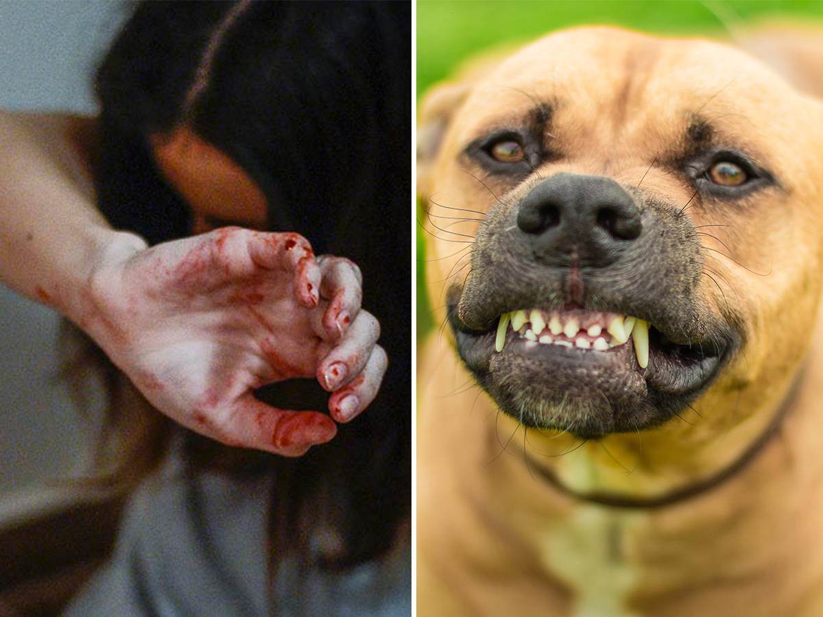  Pas izujedao devojčicu u Beogradu 