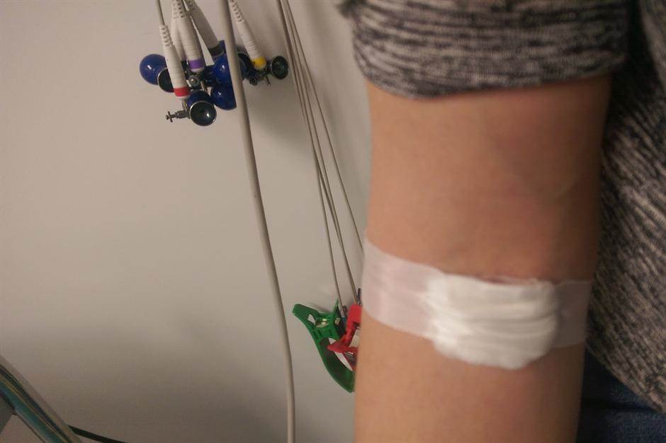  Hepatitis C - obolelo 25 pacijenata u Nišu 