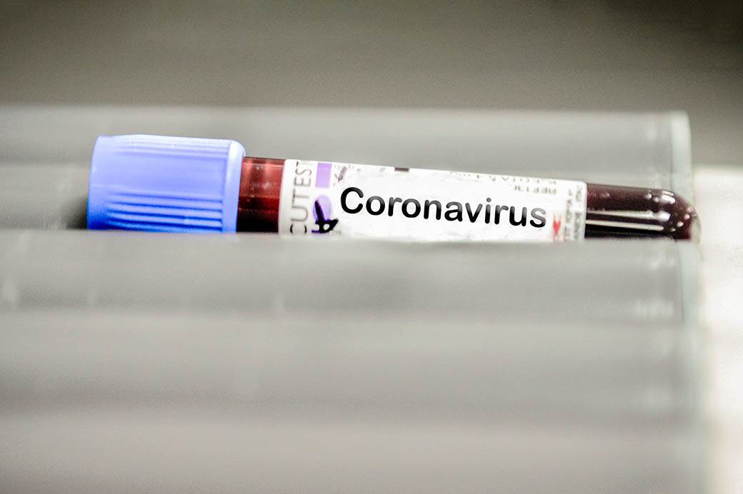  Korona virus testiranje test samoprocene na sajtu e-zdravlje 