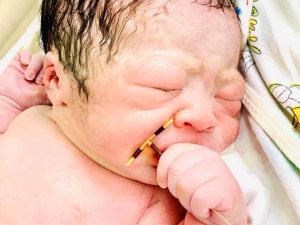  Novorođena beba drži u ruci kontraceptivno sredstvo fotografije 