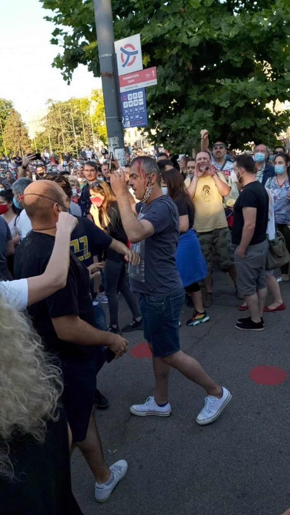  Protesti Beograd Sergej Trifunović napadnut 