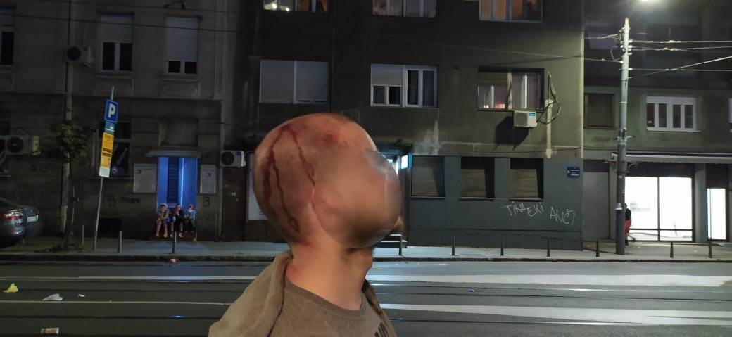  Protesti u Beogradu povređen novinar Bete 