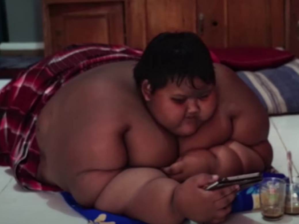  najdeblji decak na svetu smrsao 107 kilograma 