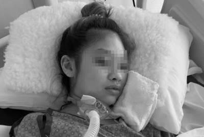  Devojka umrla tokom povećanja grudi 