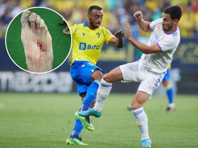  Eden Azar slomio stopalo fudbaleru i dobio žuti karton 