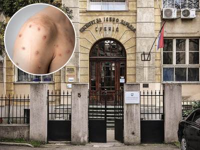  Male boginje potvrđene kod još tri osobe u Beogradu 