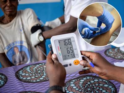  Umrle dve osobe u Gani od najsmrtonosnijeg virusa 