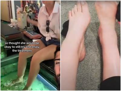  Amputirali joj prste zbog tretmana gde ribice jedu mrtvu kožu 