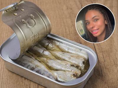  Kako sardine utiču na kožu 