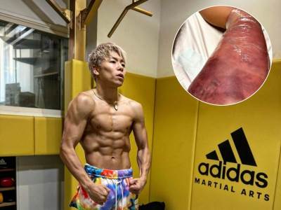  Japanski borac pokazao povrede nakon kik boks meča fotografije 
