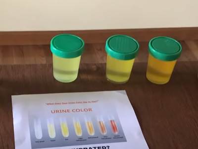  urin 