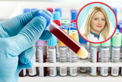  VAŽNO ZA ANEMIJU! PITALI SMO SPECIJALISTU: Koliko treba da čuvamo rezultate krvne slike 