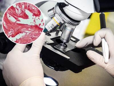  Muški polni organ pod mikroskopom 