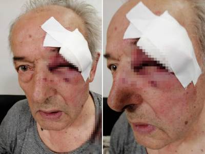  Uhapšen muškarac koji je pretukao generala u penziji Vukajla Čađenovića 