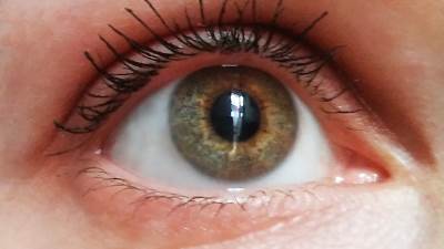  Simptomi polnih bolesti u očima 