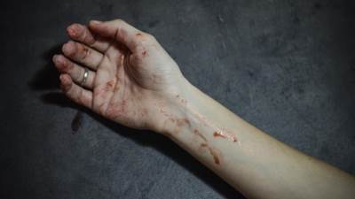  Sremska Mitrovica - žena izbodena nožem, s leđa 