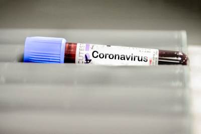  Korona virus u Ivanjici 