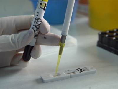  testovi na koronu testiranje pcr antigenski igg igm antitela kbc bezanijska kosa 