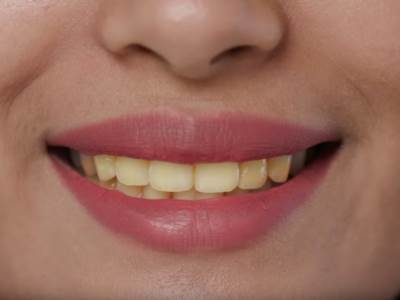  Koji lekovi mogu da utiču na zdravlje zuba 